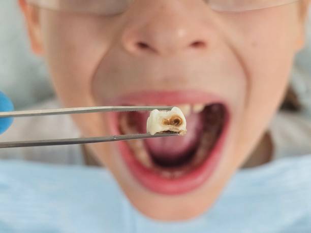 Best Emergency Dentist for Lost Fillings or Crowns in Conley, GA